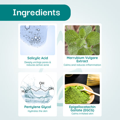 Vissence Acne Shield Serum